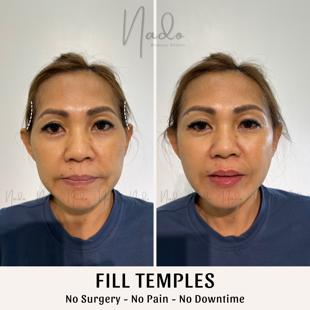 THE BENEFITS OF HA COLLAGEN IN MALAYSIA AND WHERE TO GET IT