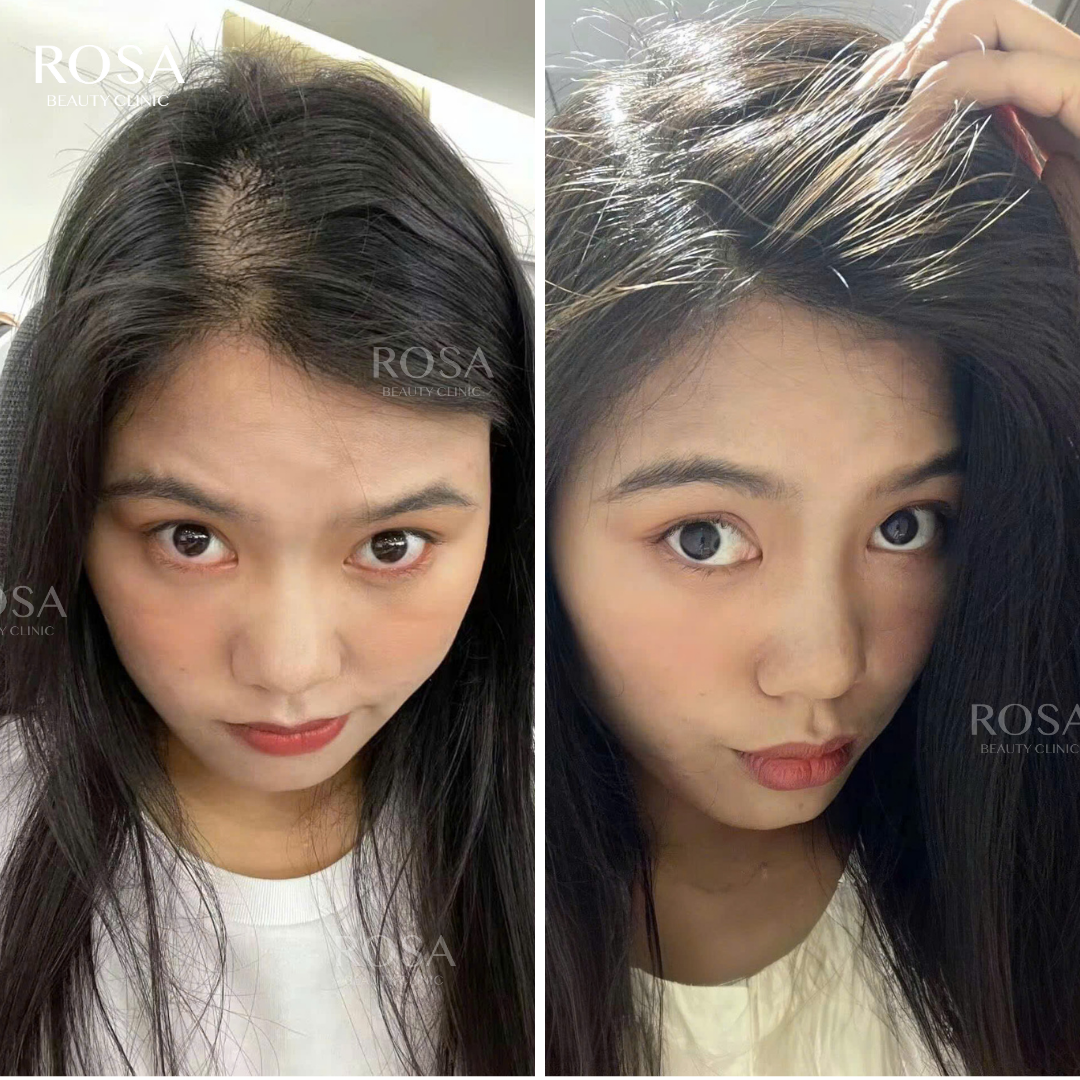 Nanomax Hair